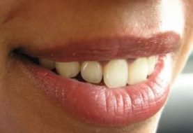 Sveiki dantys garantuoja ne tik žavingą šypseną
