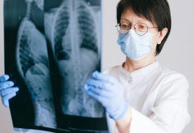 Skystoji biopsija – daugiau galimybių plaučių vėžiui ištirti